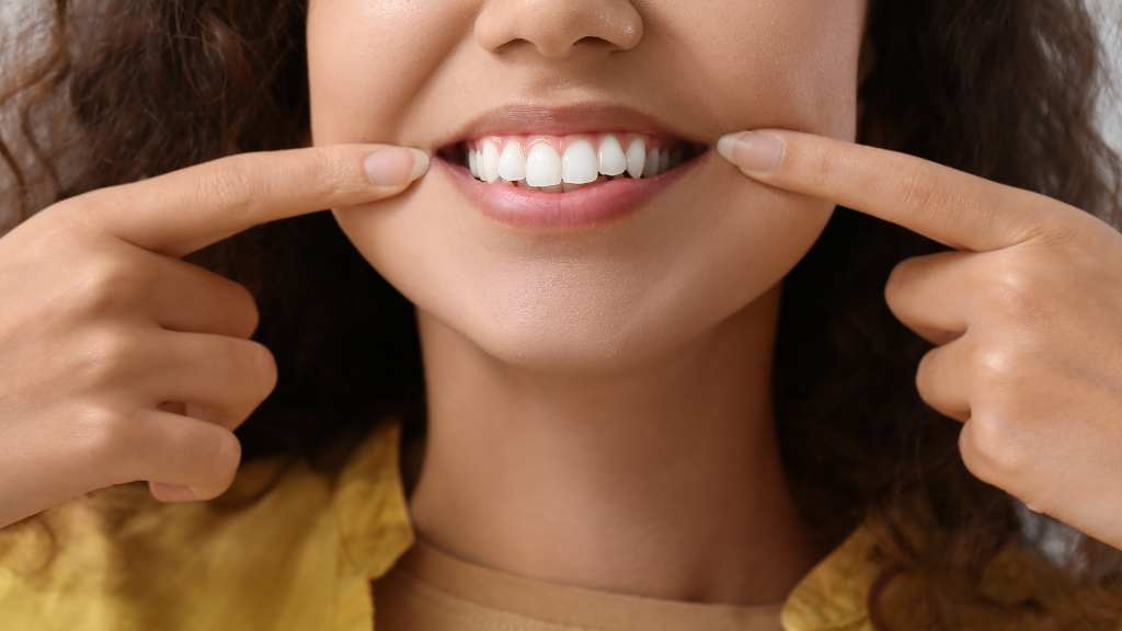 dental-veneers-calgary-alberta-58th-ave-se