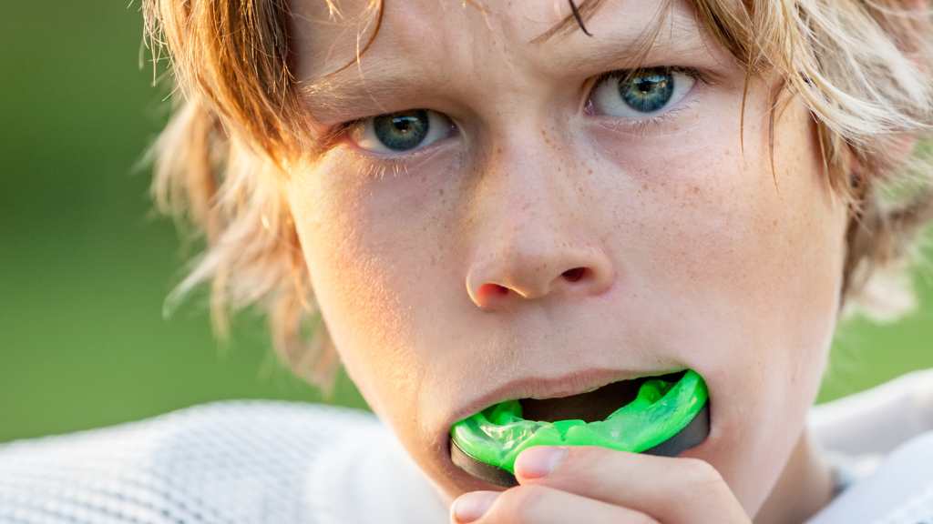 sport-mouth-guards-dentist-calgary-58th-ave-se