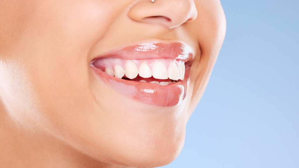 teeth-whitening-calgary-alberta-58th-ave-se