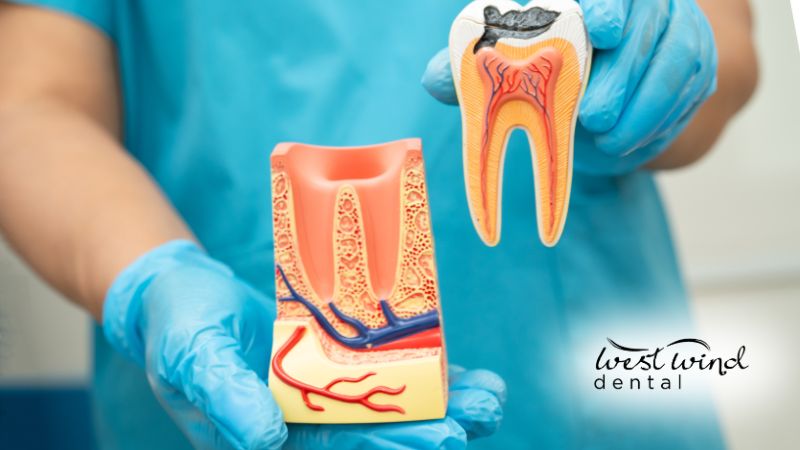 root-canals-dentist-calgary